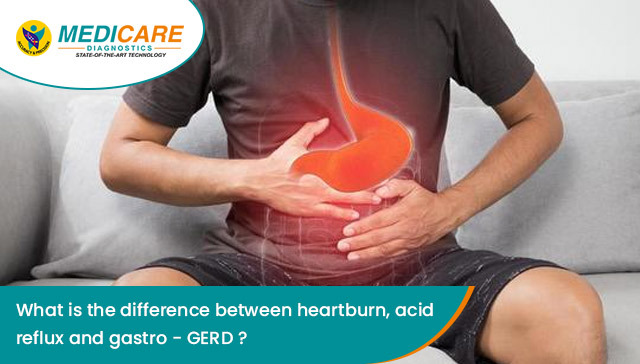 What is the difference between heartburn, acid reflux and gastro-esophageal reflux disease (GERD)?