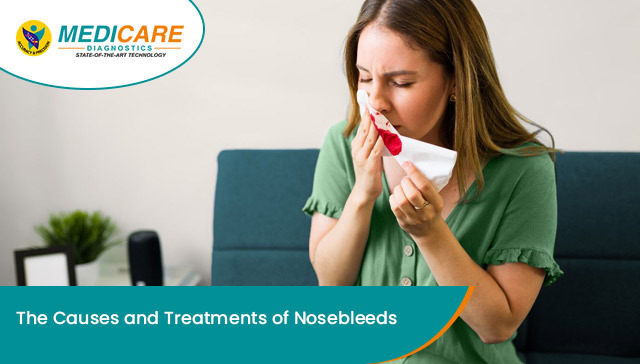 The Causes and Treatments of Nosebleeds